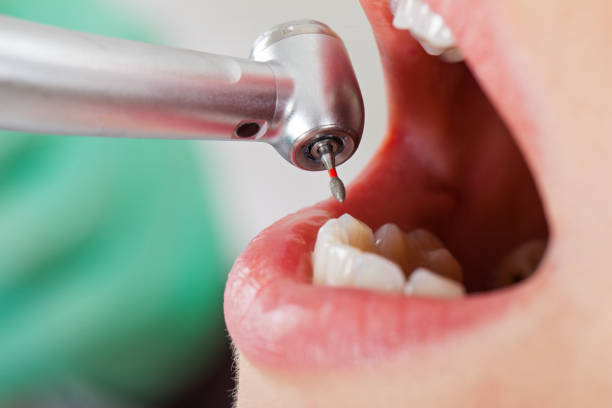 Best Broken Tooth Emergency  in Harpersville, AL